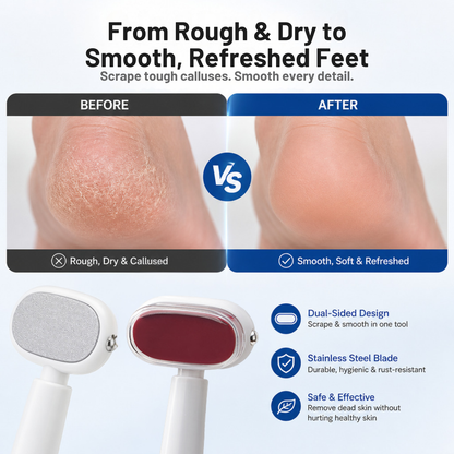 Dual-Sided Stainless Steel Foot Callus Remover & Pedicure Scraper